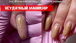 видео: Неудачный маникюр, все сломалось под мясо😱 картинка: Неудачный маникюр, все сломалось под мясо😱