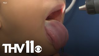 Respiratory viruses on the rise in Arkansas