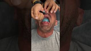 Balloon therapy 🎈 #shorts