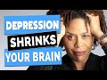 Do Antidepressants Shrink Your Brain? No but Depression Does.