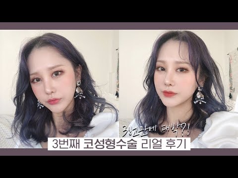 쌩리얼 3번째 코 재수술 후기 🤭 <strong>코성형수술</strong> 3번이나 한 이유 &amp;amp; 자가늑연골 사용 &amp;amp; 수술 당일부터 2주 경과 모습 &amp;amp; 가격 정보