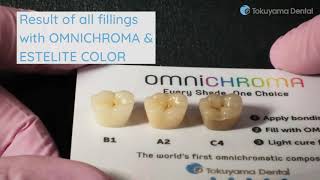 : Example of use: OMNICHROMA by TOKUYAMA DENTAL