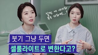 부종(붓기)을 방치하면 셀룰라이트로 변한다⁉️ | “비만의 원인, 전부 지방 때문일까요?”