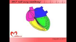 Урок 8. Видеокурс &quot;ЭКГ под силу каждому&quot;.