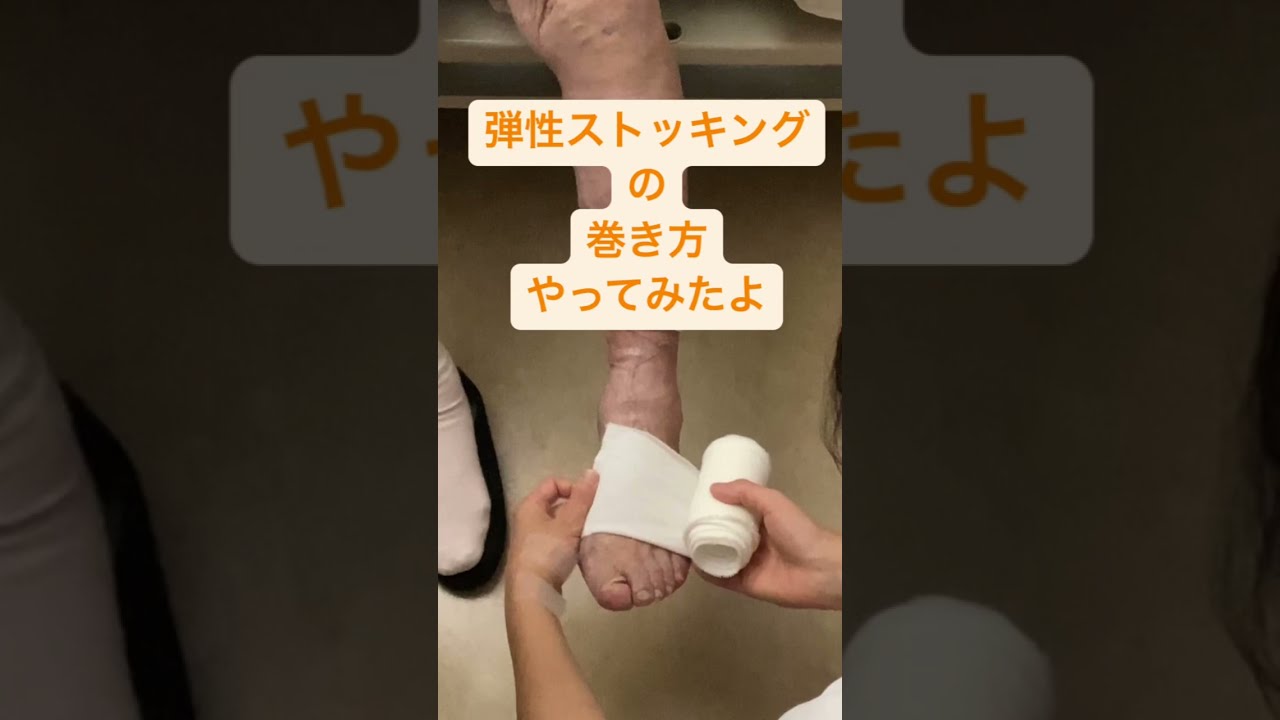弾性ストッキングの巻き方