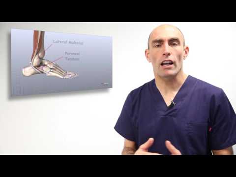 Vídeo: Qui tracta la tendinitis peroneal?
