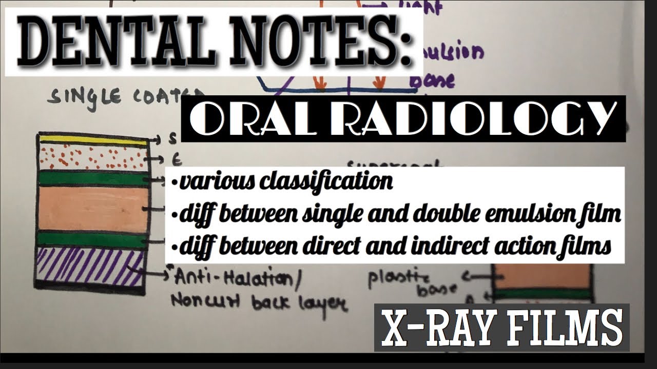 XRAY FILMS CLASSIFICATION ORAL RADIOLOGY DENTISTRY LECTURES YouTube