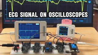 Celebrity ECG Signal Processing: From Amplifier & Filters to Oscilloscope Display Net Worth