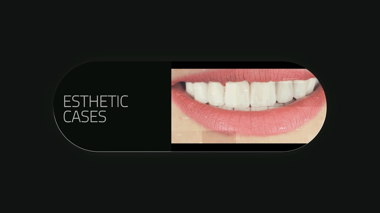 Islam Shehata reume video