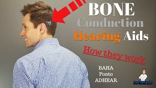 How Bone Conduction Hearing Aids Work | Cochlear BAHA, Oticon Medical Ponto, Medel ADHEAR