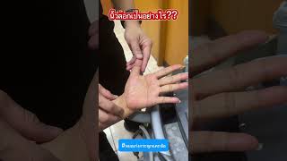 นิ้วล็อคเป็นอย่างไร? #หมอเก่งกระดูกและข้อ #นิ้วล็อค #ปวดนิ้ว #ปลอกหุ้มเส้นเอ็นอักเสบ