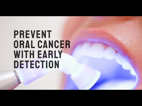 Early Detection of Oral Cancer part1 - YouTube