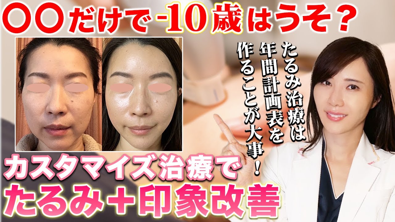 女医が受けている美容施術と年間計画を公開！ 切らずに確実に若返る方法