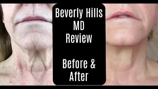 Beverly Hills MD Dermal Repair Complex—Lift and Firm Sculpting Cream—Before and After—Anti-Aging