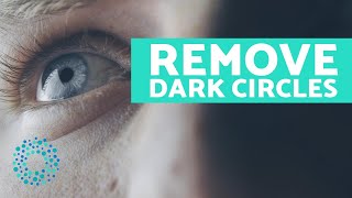 How To Remove Dark Circles Under The Eyes At Home