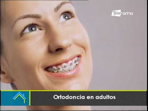 Ortodoncia en adultos