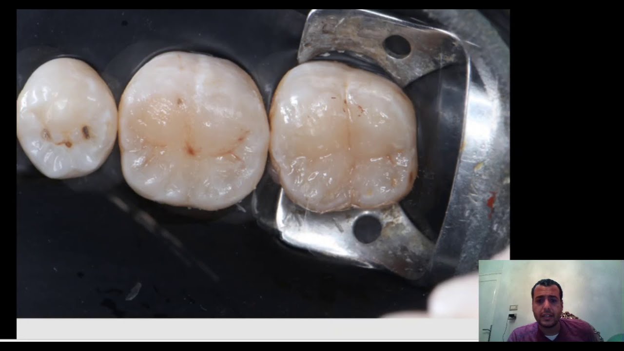 simple posterior anatomy