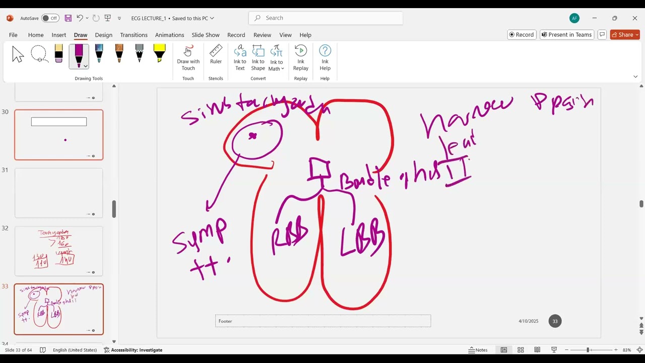 ECG part 2 The Simplified Algorithms For Tachy And Brady Arrhythmia Prof Antoine Fakhry AbdelMassih