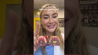 Famous this why you may not see a gap with your expander!! #expander #braces #crossbite Profile