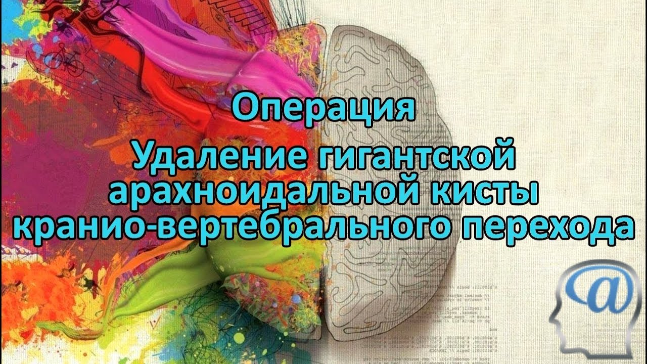 Операция. Удаление гигантской арахноидальной кисты головного мозга ...