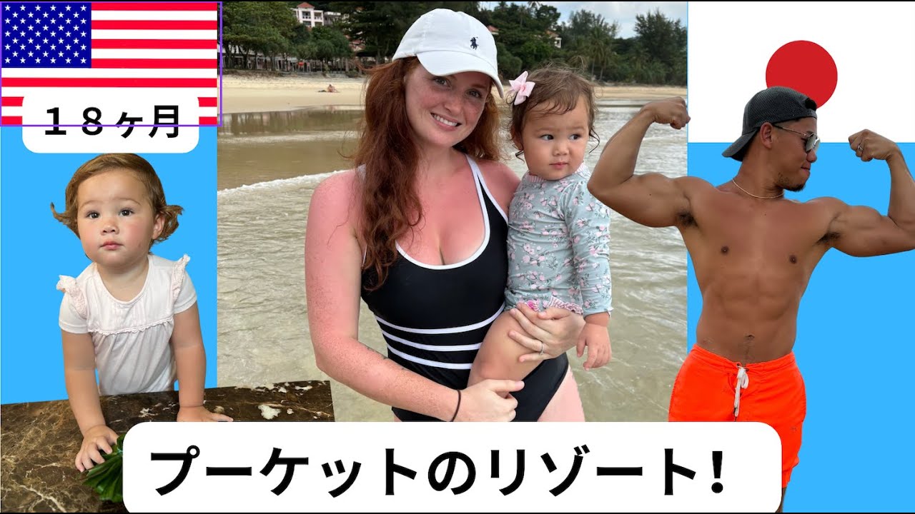 日焼けしすぎた【国際結婚】【18ヶ月】