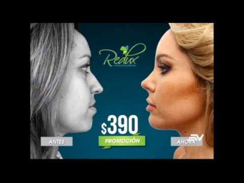 Rinoplastia No Quirurgica En Vivo Encontactoecuavisa Youtube