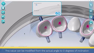 MillBox How To: Reduce the Cavity Axis Angle