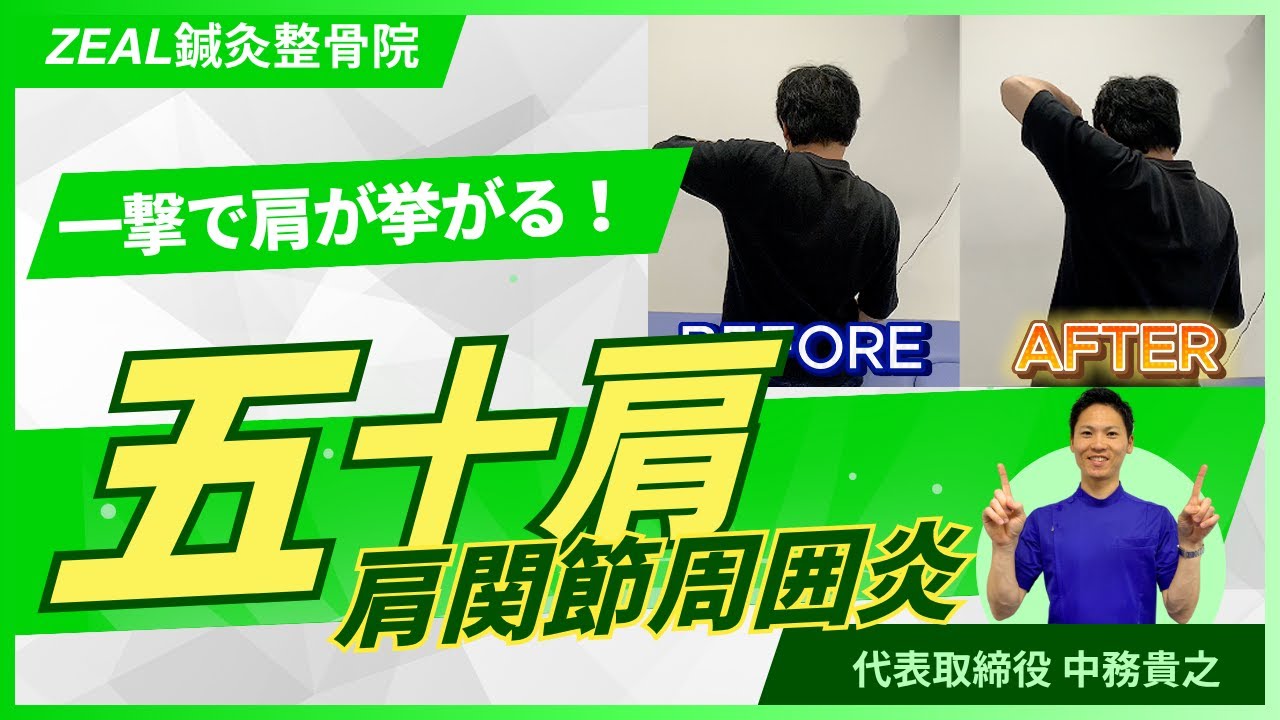 四十肩・五十肩 - 岡山市南区・中区ジール鍼灸整骨院・整体院