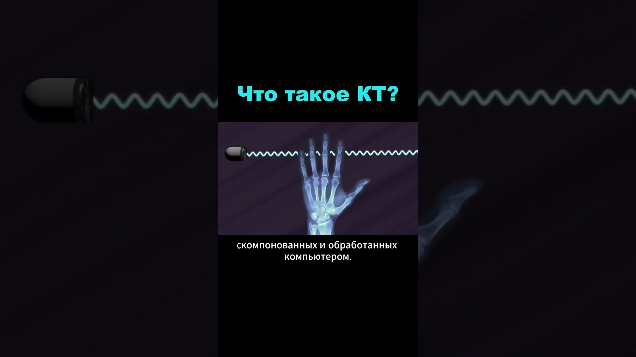 КТ - принцип работы и области применения #меднавигатор #кт #диагностика #медицина #здоровье