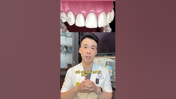 niềng răng bằng mắc cài sứ #nhakhoaquocteachau #dentist #duet #niengrang