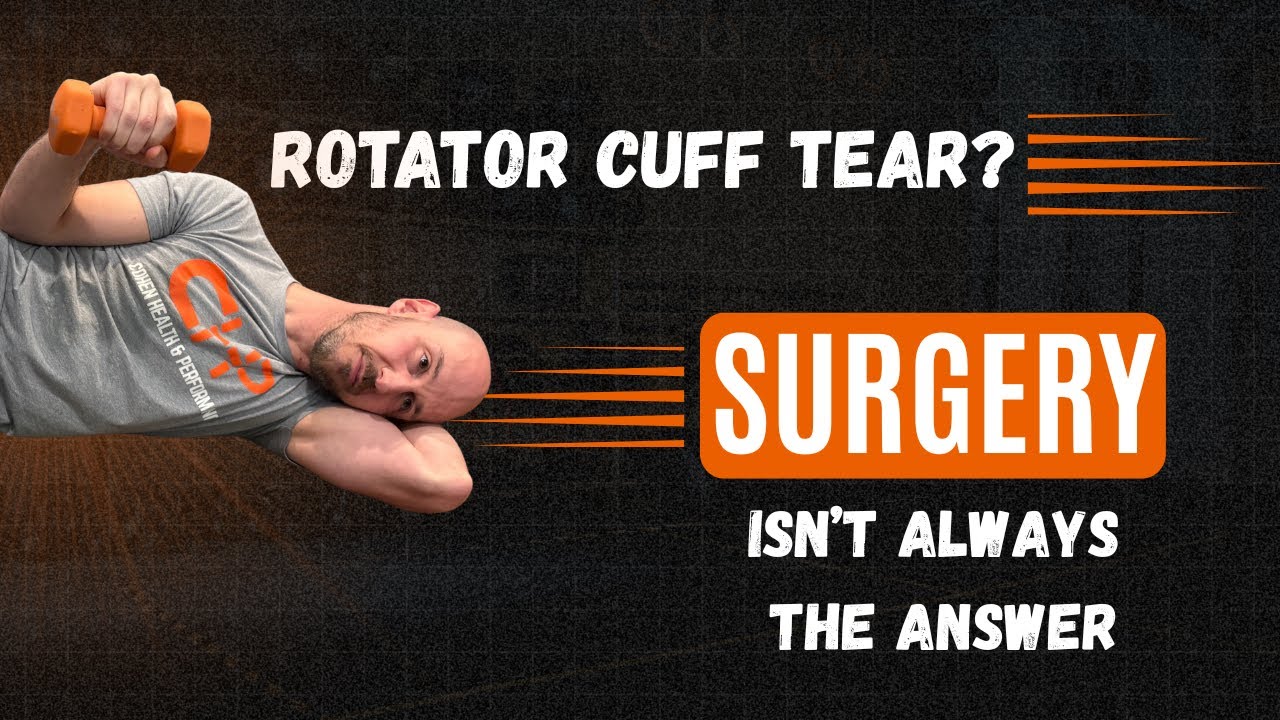 Rotator Cuff Tear? Why Surgery Isn’t Always the Answer