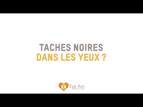 Vidéo: Cataracte - Points Flottants Noirs, Sombres Et Blancs Dans Les Yeux