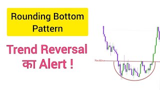 Rounding Bottom Pattern Explained🔥 Technical Analysis
