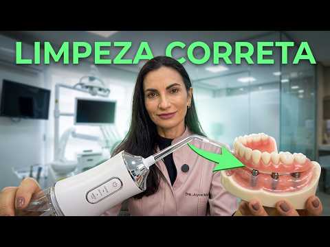 Implante Dentário e Protocolo: Cuidados Essenciais para Evitar Problemas e Aumentar a Durabilidade