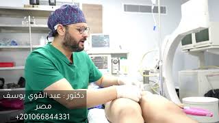 العضو المدفون في الاطفال مضاعفات ختان الذكور .تجميل العضو دكتور عبدالقوي يوسف