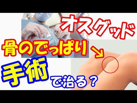 オスグッドの恐怖？でっぱりは手術で治る？大人になってからの影響とは！骨の変形に一生悩まされる！？