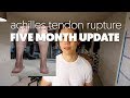 Achilles Tendon Rupture || Five Month Post Op Update