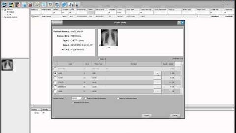 Image Suite exportPACS