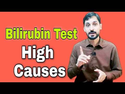 Bilirubin Test | Causes of High Bilirubin | Total Bilirubin | Direct Bilirubin | Indirect Bilirubin