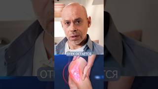 КАК отличить ушиб от разрыва сухожилия?