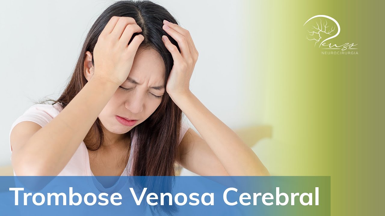 Trombose Venosa Cerebral associada à vacinação da COVID-19 - Dr Luiz Penzo
