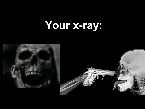 Mr Incredible Becoming Uncanny (Your X-ray)