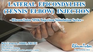 Exclusive TENNIS ELBOW (LATERAL EPIDONDYLITIS) INJECTION: Step-By-Step Teaching Simulation Details