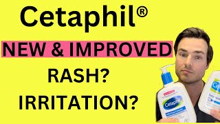 Cetaphil facewash allergy or irritation