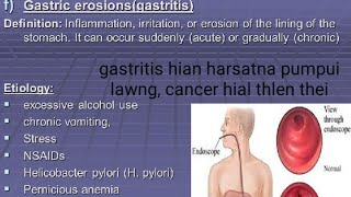 Gastritis Pumpui Sa Hut Hut Lo Awm Chhan Leh In Ven Dan