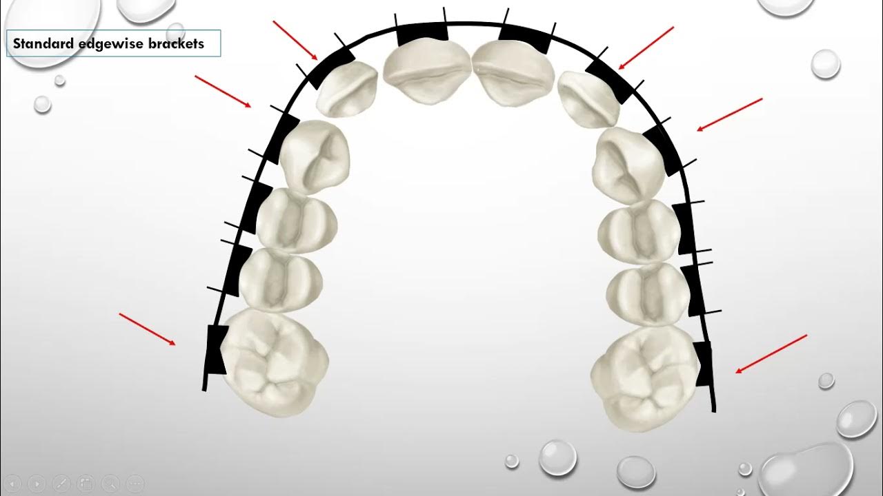 First Order Bends (In and Out) YouTube