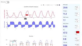 VentMon T0.2 Introduction