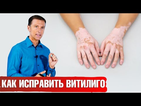 Video: Витилиго патчтарын макияж менен жабуунун 3 жолу