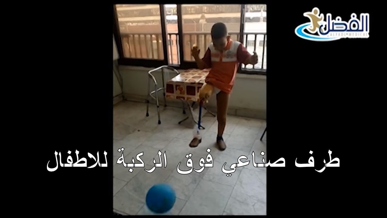 أحدث طرف صناعى فوق الركبة للأطفال بركبة متحركة للعب الكرة و جميع الانشطة | الفضل ميديكال 01094402330