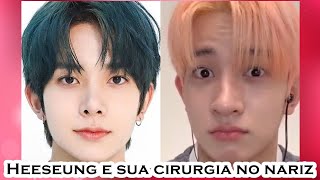 ENHYPEN Heeseung e sua cirurgia no nariz